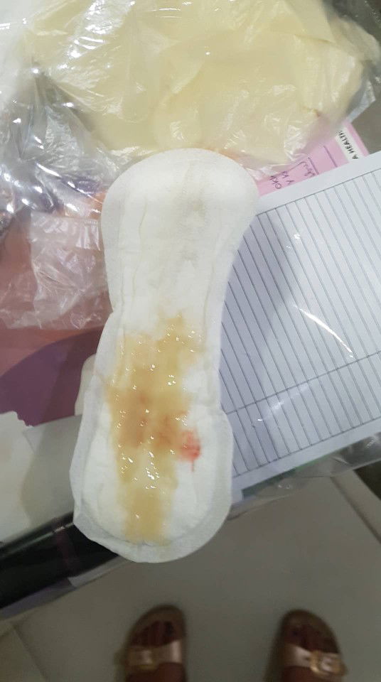 Lumabas ang Mucus plug, after nian may lumabas na buong dugo