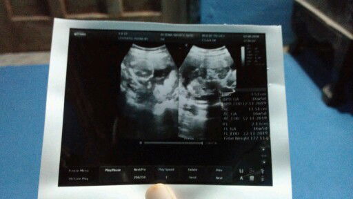 Nasihat Terbaik ala Mertua