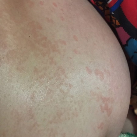 แม่ๆบ้านไหนเป็นแบบนี้มั้งค่ะ