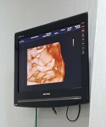 Spog RS Dhia ciputat recommended