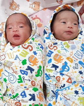 Kelahiran kembarku