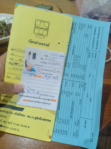 ภาวะเบาหวาน