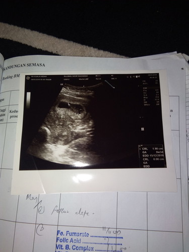 scan