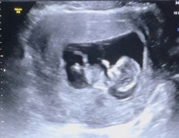 WatcharaporN P. profile icon