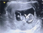WatcharaporN P. profile icon