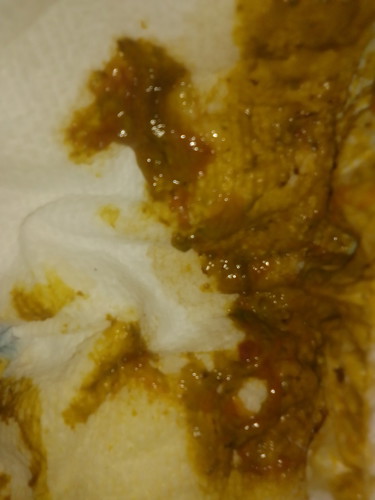 Normal po kaya? O need na ipacheck stool ni baby?