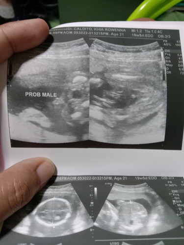 Transverse lie baby position