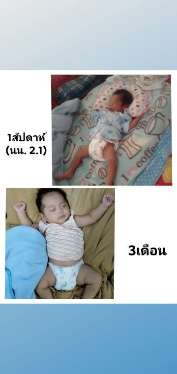 จากเจ้าตัวเล็กในวันนั้นมาเป็นเจ้าอ้วนในวันนี้.?