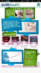 Tongue Tie / Lidah Pendek