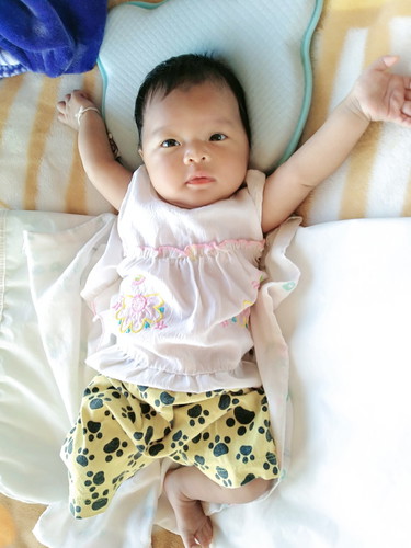 หัวนมแตก