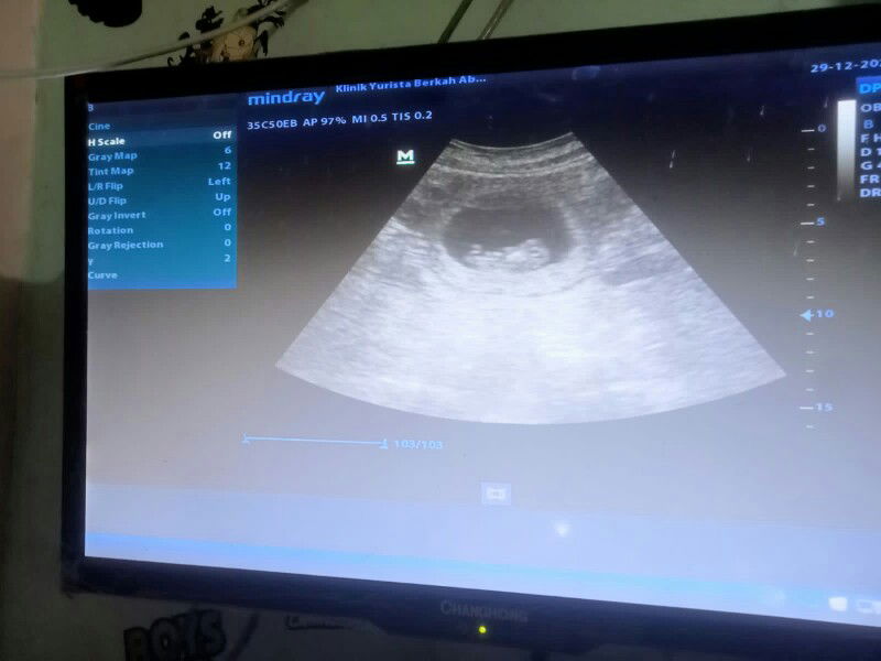 fitrii sumiati profile icon