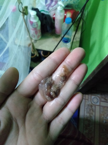 สอบถาม