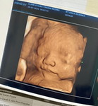 Siska Silviana profile icon