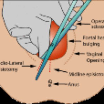 Jahitan dan HB pasca melahirkan