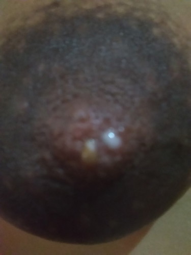 Milk nipple