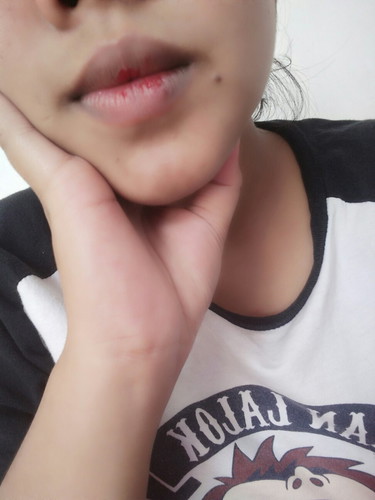 bibir pecah pecah