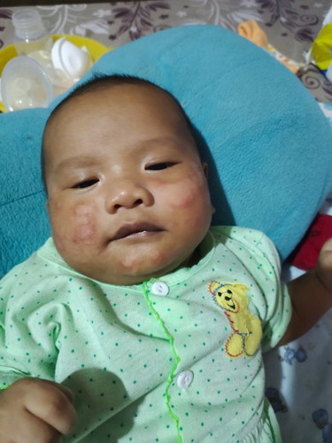 ruang asi atau alergi...????