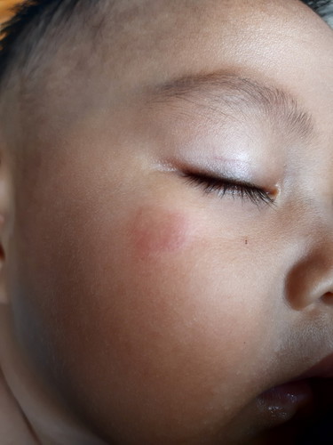 ใครรู้ไหมคะทำยังไงหาย