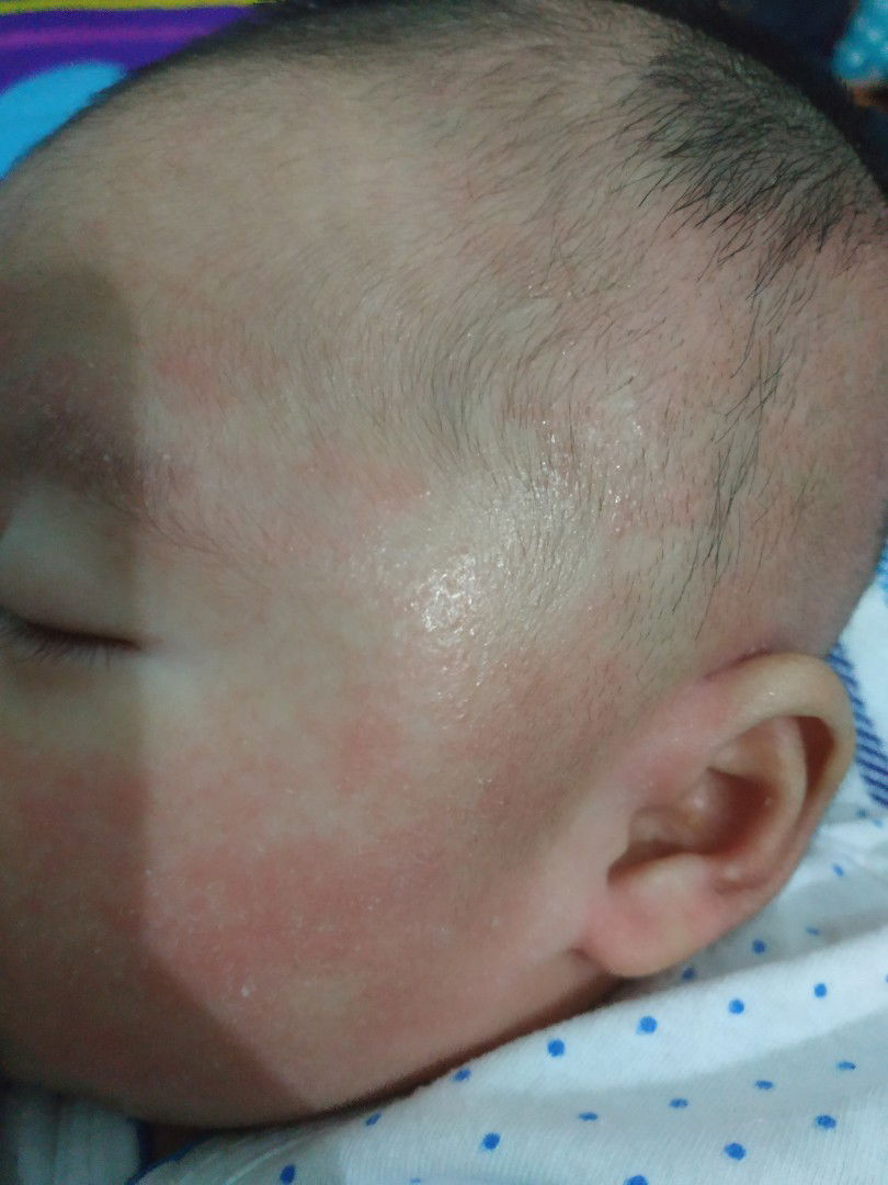 ada yg pernah mengalami babynya seperti ini?