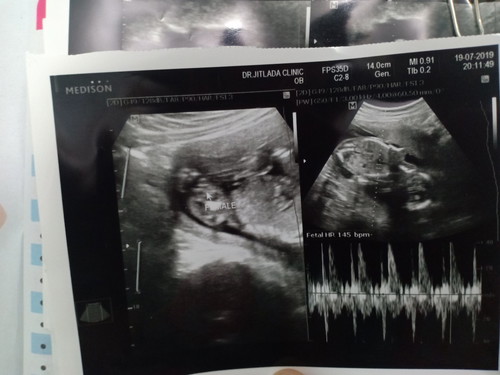 ช/ญ ใครดูออกบ้างคะ