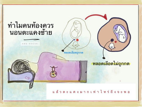 นอนตะแคงซ้ายดีที่สุด อ่านสักนิดคะ