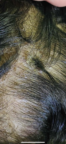 ปรึกษาแนวทางการรักษาค่ะ