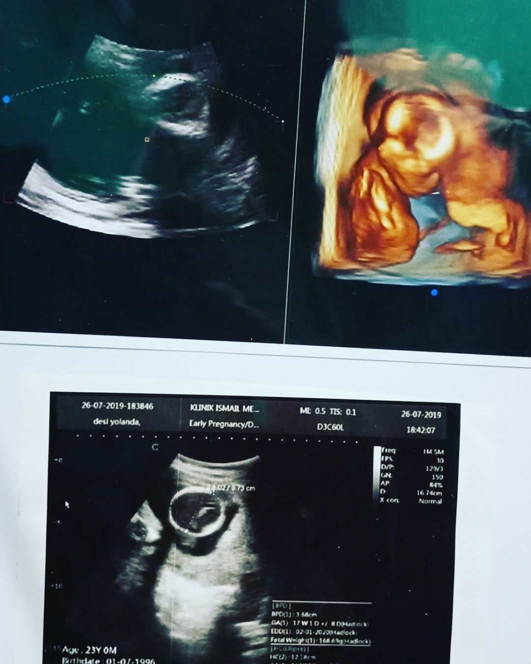 baby boy or baby girls