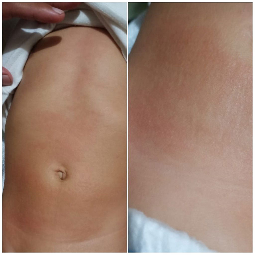 Anak saya kenapa ya?