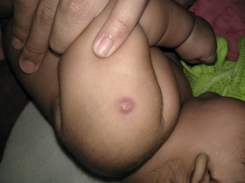 ขอสอบถาม