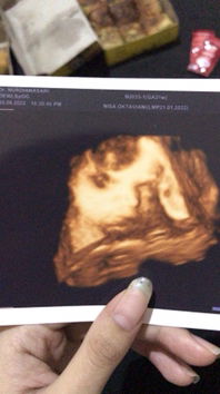 Nisa Oktaviani profile icon