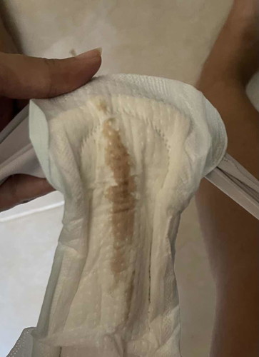 แบบนี้ต้องไปหาหมอมั้ยคะ