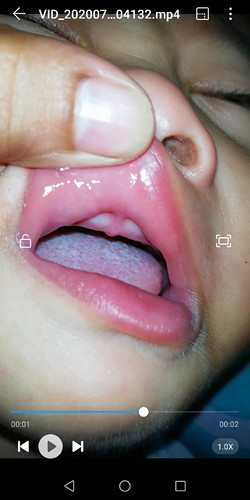about his teeth