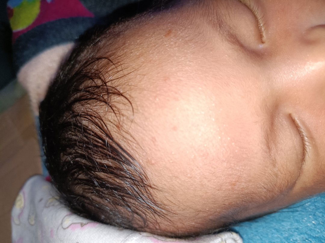 Assalamualaikum bun mau nanya kalo bayi kulit nya keluar gini normal ga yah? Terus kasih obat apa