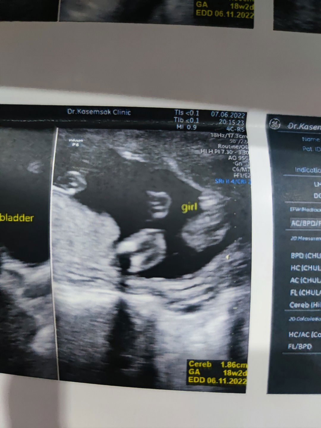 Supattra profile icon