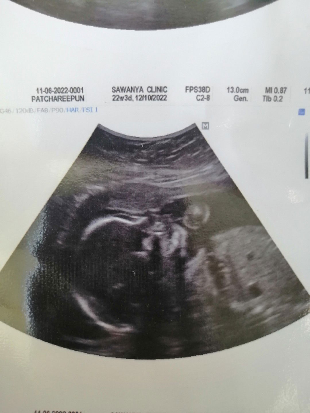 Patchareepan Ponpansab profile icon