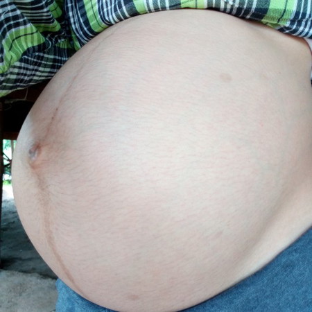 35วีคกับ4วัน อีก3วัน36วีคแล้วจ้า