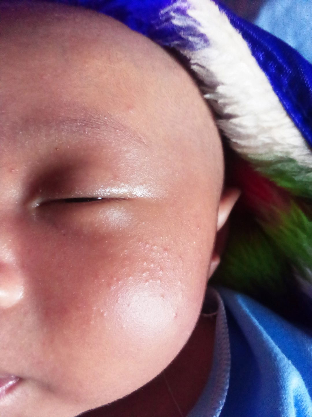 Bintik merah pada Newborn