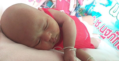 ผื่นขึ้นไม่หาย