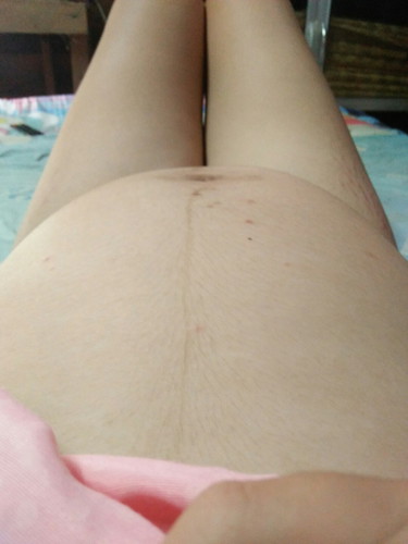 ??