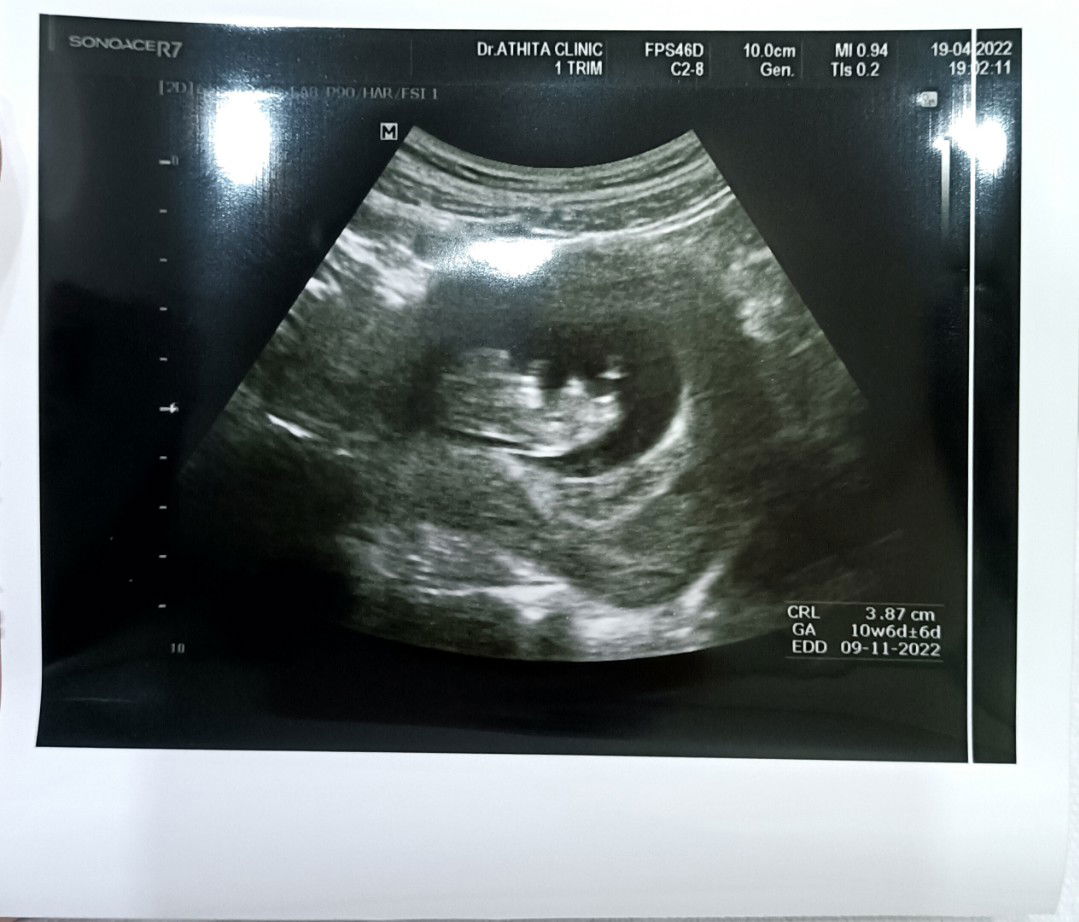 wi wilaiwan profile icon