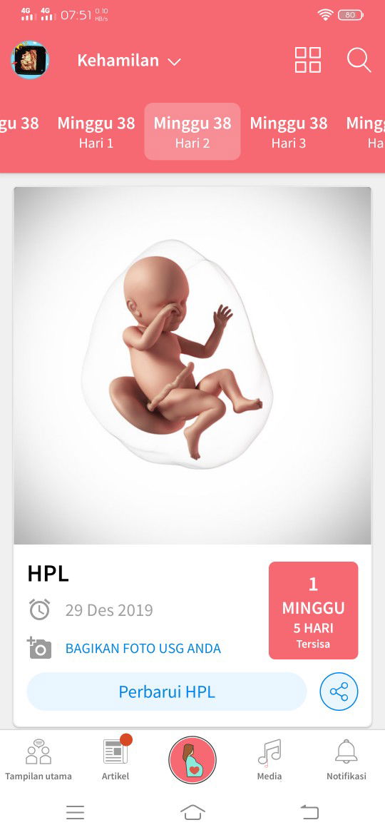 Symphysis Pubis Disfungtion