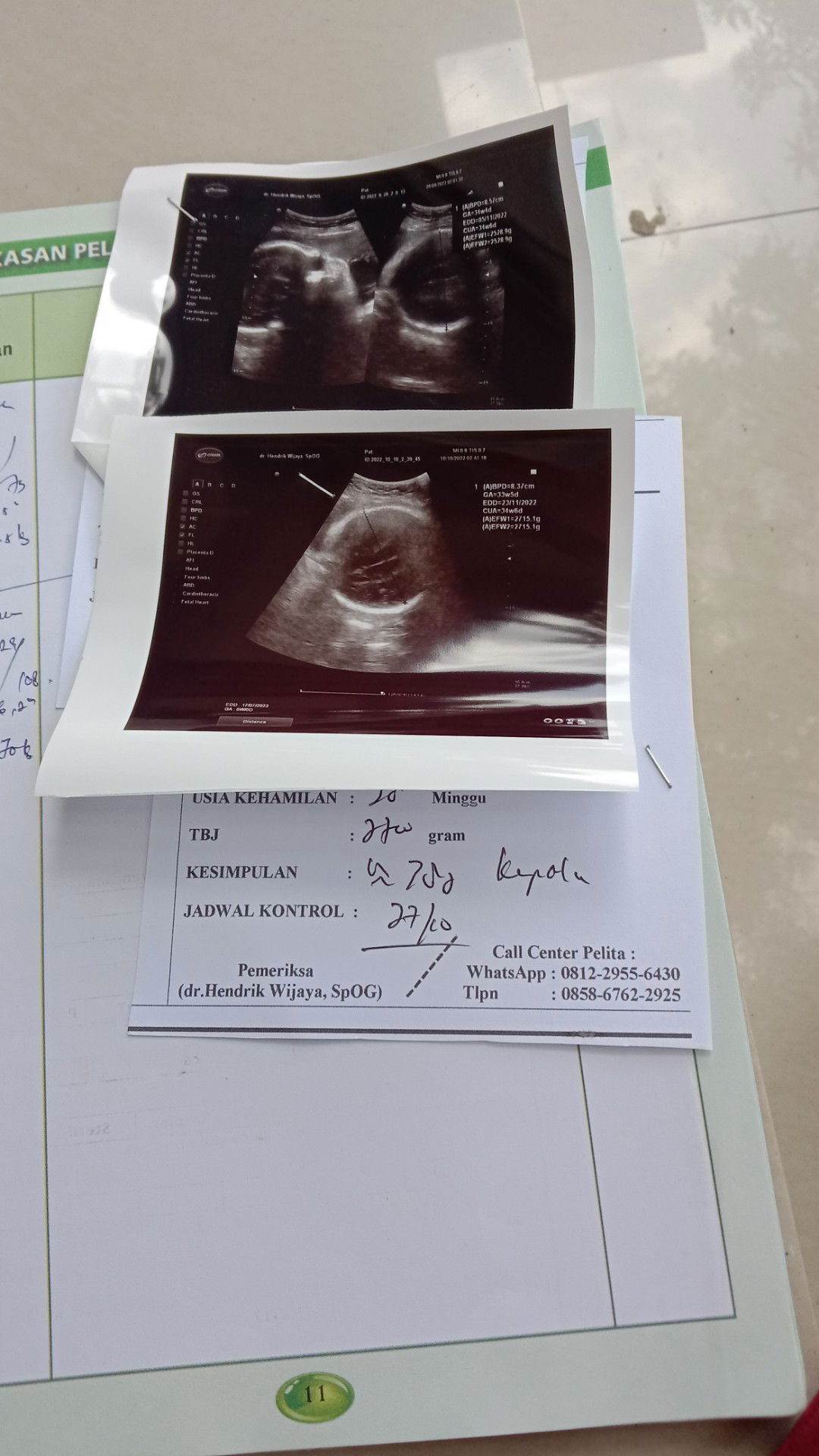 Ssussii Nuraenii profile icon