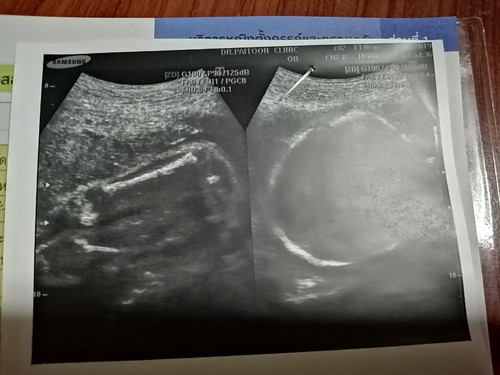 แบบนี้ผู้หญิงหรือผู้ชายค่ะ