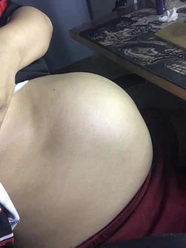 ปากมดลูก