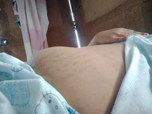 15Weeks3days Preggy/Twins