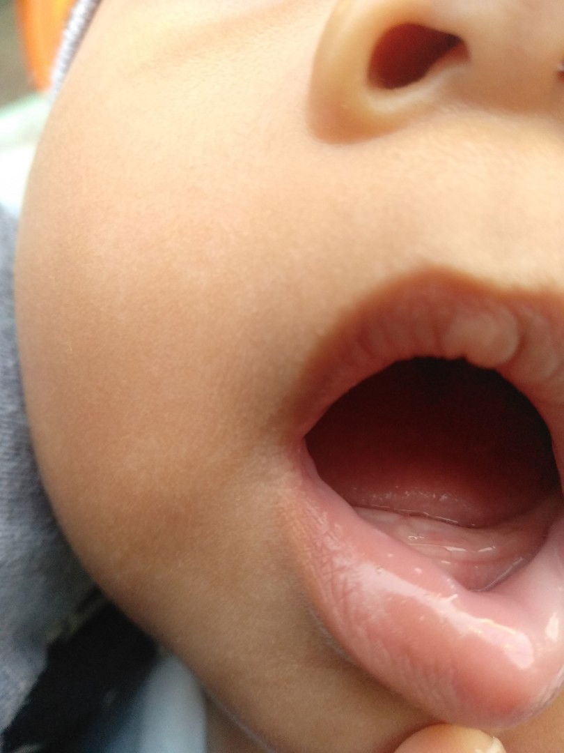 mencret sudah 5 hari