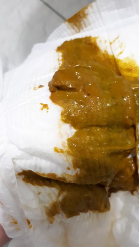 น้องอึเหม็นเป็นก้อน