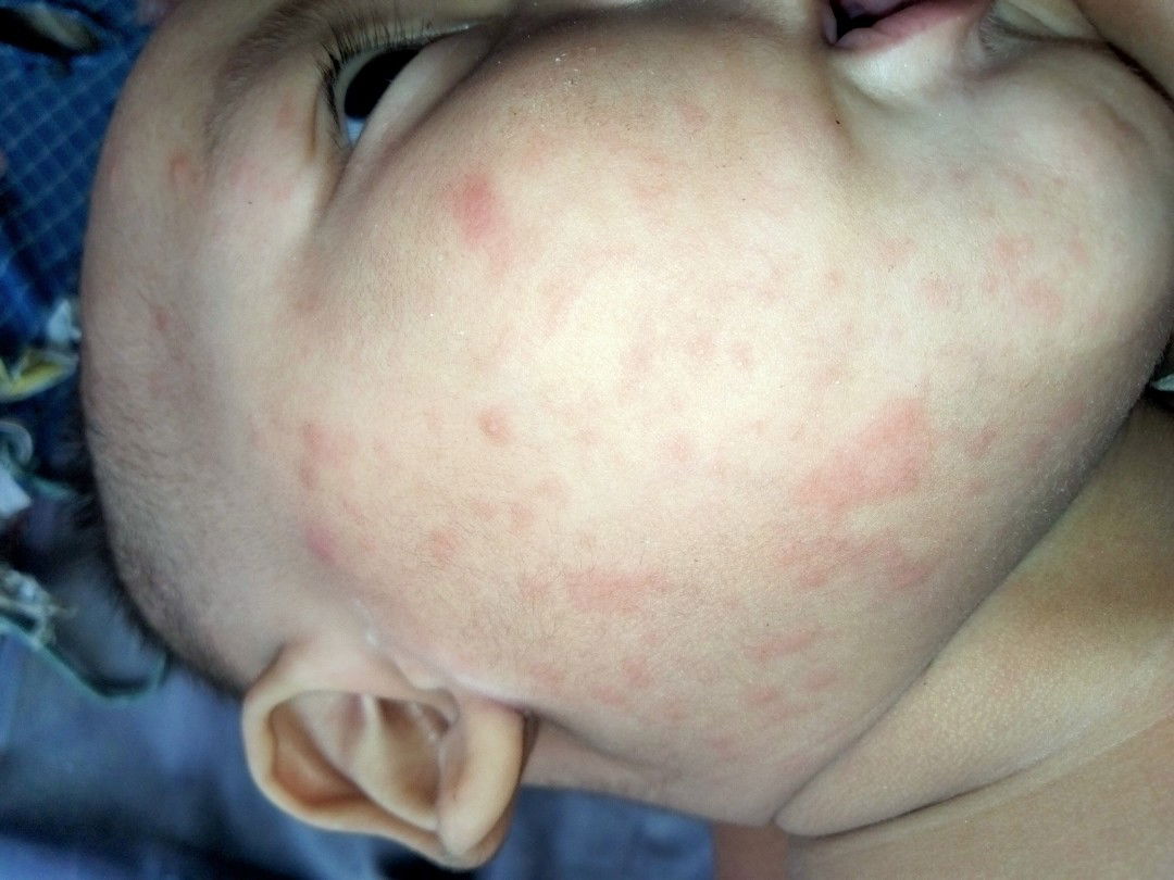 Ada yang tau atau anaknya yang udah pernah ?