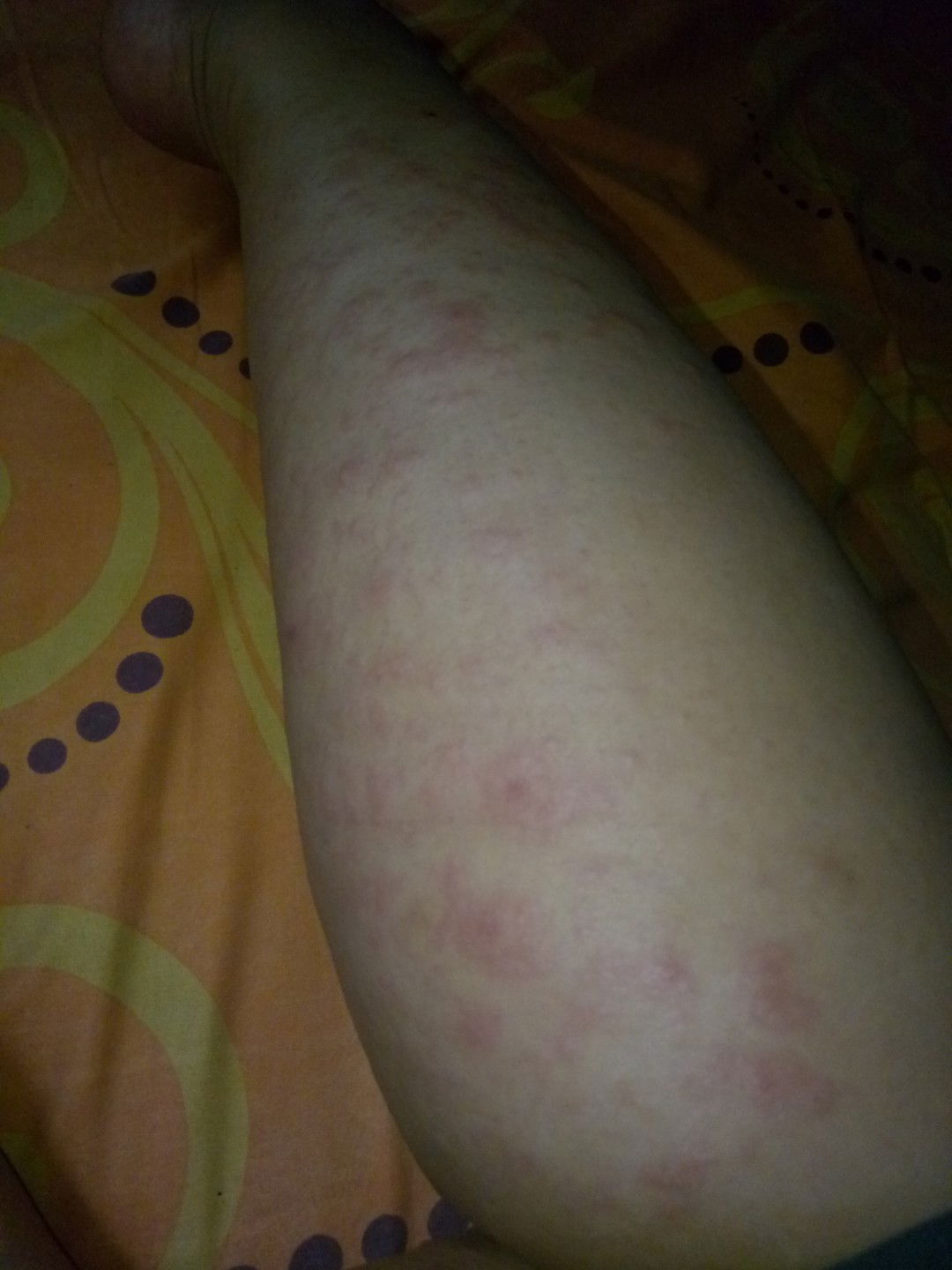 alergi setelah melahirkan