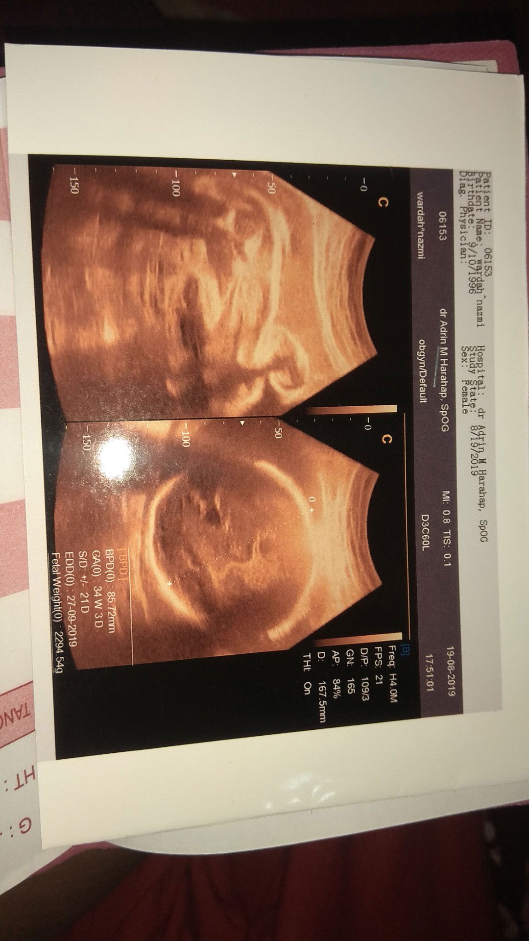 Bingung Mengenai Usia Kehamilan..